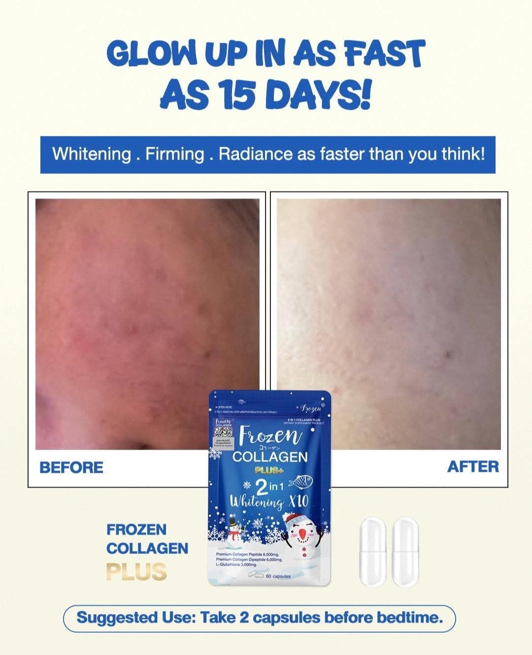 Frozen Collagen PLUS+ 2-in-1 Whitening X10 - 60 Caps Collagen Glutathione. Original&Authentic💯✅️